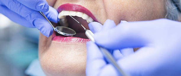 Best Broken or Chipped Tooth Repair in Bertram, TX