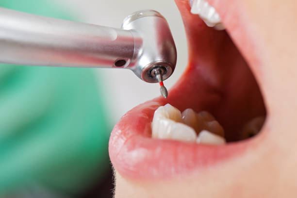 Best Walk-In Emergency Dental Services in Bertram, TX